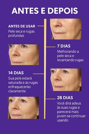Sérum Retinol Anti-Rugas Combate Linhas De Expressão, olheiras, Flacidez e Viço