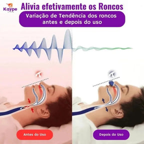 Dispositivo de Respiração para Ronco SleepGuardian – Sem Máscara, Sem Tubos e Sem Fios